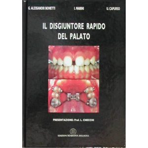 Il disgiuntore rapido del palato